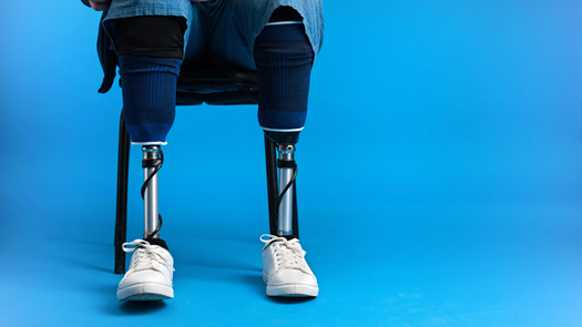 robotic joint replacement